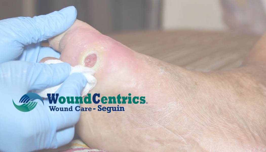 CHRISTUS Wound Care Medical Center San Marcos | WoundCentrics, LLC